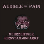 »Mehrzeitiger Hirnstamminfarkt« cover